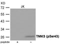 Western blot analysis of extracts from JK cells using TNNI3 (Phospho-Ser43) Antibody.The lane on the left is treated with the antigen-specific peptide.