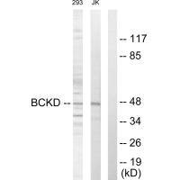 Western blot analysis of extracts from 293 cells and Jurkat cells, using BCKD antibody.