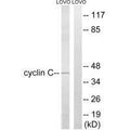 Western blot analysis of extracts from LOVO cells, using Cyclin C (Ab-275) antibody.