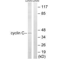 Western blot analysis of extracts from LOVO cells, using Cyclin C (Ab-275) antibody.