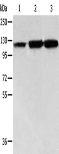 Gel: 8%SDS-PAGE, Lysate: 40 ug, Lane 1-3: PC3 cells, human colon cancer tissue, Human liver cancer tissue, Primary antibody: CSB-PA183277(HSPH1 Antibody) at dilution 1/500, Secondary antibody: Goat anti rabbit IgG at 1/8000 dilution, Exposure time: 40 seconds