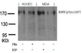 Western blot analysis of extracts from PMA-treated HUVEC cells or EGF-treated MDA cells using EGFR(phospho-Tyr1197) goat polyclonal antibody.