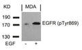 Western blot analysis of extracts from MDA cells untreated or treated with EGF using EGFR(Phospho-Tyr869) Antibody.