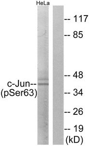 Western blot analysis of extracts from HeLa cells using c-Jun (Phospho-Ser63) Antibody.The lane on the right is treated with the antigen-specific peptide.