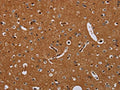 The image on the left is immunohistochemistry of paraffin-embedded Human brain tissue using CSB-PA185718(KLK13 Antibody) at dilution 1/20, on the right is treated with fusion protein. (Original magnification: ×200)