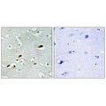 Immunohistochemistry analysis of paraffin-embedded human brain tissue, using TIP60 antibody.