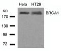 Western blot analysis of extracts from Hela and HT29 cells using BRCA1(Ab-1423) Antibody.