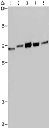 Gel: 6%SDS-PAGE, Lysate: 40 ug, Lane 1-5: MCF7 cells, 293T cells, HT29 cells, Hela cells, Jurkat cells, Primary antibody: CSB-PA187496(CHEK2 Antibody) at dilution 1/150, Secondary antibody: Goat anti rabbit IgG at 1/8000 dilution, Exposure time: 2 minutes