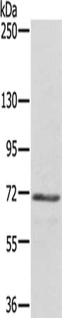 Gel: 6%SDS-PAGE, Lysate: 40 ug, Lane: 823 cells, Primary antibody: CSB-PA187891(DTNB Antibody) at dilution 1/300, Secondary antibody: Goat anti rabbit IgG at 1/8000 dilution, Exposure time: 2 minutes