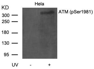 Western blot analysis of extracts from Hela cells untreated or treated with UV using ATM(Phospho-Ser1981) Antibody
