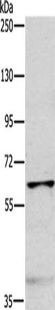 Gel: 6%SDS-PAGE, Lysate: 40 ug, Lane: Mouse muscle tissue, Primary antibody: CSB-PA189164(MYLK2 Antibody) at dilution 1/1000, Secondary antibody: Goat anti rabbit IgG at 1/8000 dilution, Exposure time: 10 minutes
