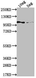 Western Blot
Positive WB detected in Recombinant protein
All lanes: Genome polyprotein Antibody antibody at 1:2000
Secondary
Goat polyclonal to rabbit IgG at 1/50000 dilution
Predicted band size: 87.3 kDa
Observed band size: 105 kDa