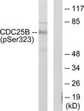 Western blot analysis of extracts from NIH/3T3 cells treated with PMA (125ng/ml, 30mins), using CDC25B (Phospho-Ser323) antibody. The lane on the right is treated with the synthesized peptide.