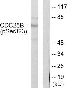 Western blot analysis of extracts from NIH/3T3 cells treated with PMA (125ng/ml, 30mins), using CDC25B (Phospho-Ser323) antibody. The lane on the right is treated with the synthesized peptide.