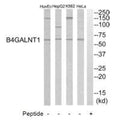 Western blot analysis of extracts from HeLa cells, K562 cells, HepG2 cells and HuvEC cells, using B4GALNT1 antibody.