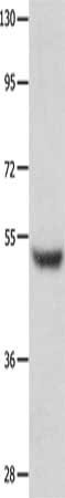 Gel: 10%SDS-PAGE, Lysate: 60 ug, Lane: Human brain malignant glioma tissue, Primary antibody: CSB-PA190393(TP73 Antibody) at dilution 1/300, Secondary antibody: Goat anti rabbit IgG at 1/8000 dilution, Exposure time: 2 minutes