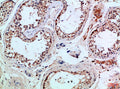 PIK3R2 Antibody – Figure 1 of 4
