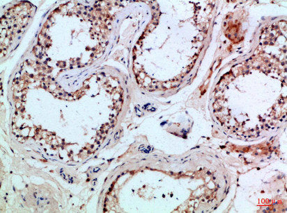 PIK3R2 Antibody – Figure 1 of 4