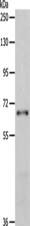 Gel: 8%SDS-PAGE, Lysate: 40 ug, Lane: Human fetal muscle tissue, Primary antibody: CSB-PA191509(BIRC2 Antibody) at dilution 1/300, Secondary antibody: Goat anti rabbit IgG at 1/8000 dilution, Exposure time: 2 minutes