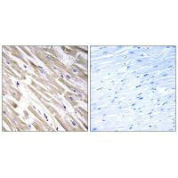 Immunohistochemistry analysis of paraffin-embedded human heart tissue using FGF18 antibody.