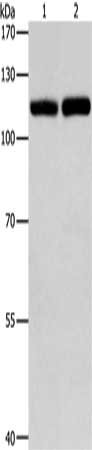 TLR3 Antibody – Figure 1 of 1