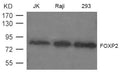 Western blot analysis of extract from JK, Raji and 293 cells using FOXP2 Antibody