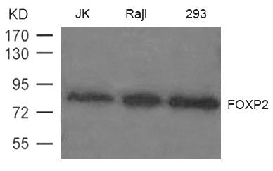 Western blot analysis of extract from JK, Raji and 293 cells using FOXP2 Antibody