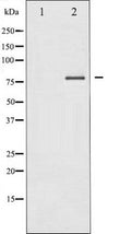 Western blot analysis of PKC delta expression in MCF7 whole cell lysates,The lane on the left is treated with the antigen-specific peptide.