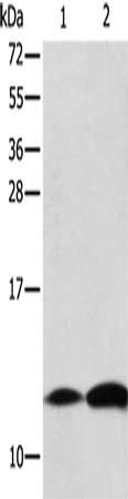 Gel: 15%SDS-PAGE, Lysate: 40 ug, Lane 1-2: Raji cells, human thyroid cancer tissue, Primary antibody: CSB-PA193585(B2M Antibody) at dilution 1/125, Secondary antibody: Goat anti rabbit IgG at 1/8000 dilution, Exposure time: 10 seconds