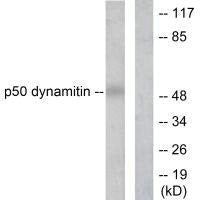 Western blot analysis of extracts from A549 cells, using p50 dynamitin antibody.