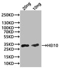Western Blot
Positive WB detected in: recombinant protein
All lanes:HEI10 Antibody at 1:1000
Secondary
Goat polyclonal to rabbit IgG at 1/20000 dilution
Predicted band size: 27.9 kDa
Observed band size: 31 kDa