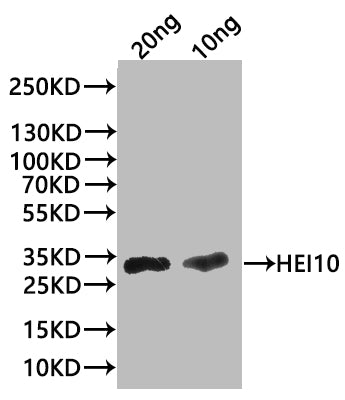 Western Blot
Positive WB detected in: recombinant protein
All lanes:HEI10 Antibody at 1:1000
Secondary
Goat polyclonal to rabbit IgG at 1/20000 dilution
Predicted band size: 27.9 kDa
Observed band size: 31 kDa