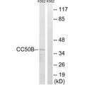 Western blot analysis of extracts from K562 cells, using TMEM30B antibody.