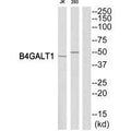 Western blot analysis of extracts from Jurkat/293 cells, using B4GALT1 antibody.