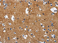 The image on the left is immunohistochemistry of paraffin-embedded Human brain tissue using CSB-PA195475(CADM3 Antibody) at dilution 1/40, on the right is treated with fusion protein. (Original magnification: ×200)