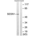 Western blot analysis of extracts from rat muscle cells, using SESN1 antibody.
