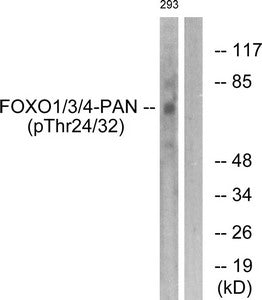 Western blot analysis of extracts from 293 cells treated with Serum using FOXO1/3/4-pan (Phospho-Thr24/32) Antibody.The lane on the right is treated with the antigen-specific peptide.
