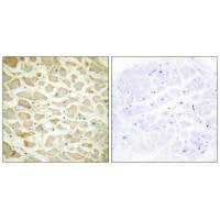 Immunohistochemistry analysis of paraffin-embedded human heart tissue using Collagen XIV α1 antibody.