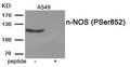 Western blot analysis of extracts from A549 tissue using n-NOS (Phospho-Ser852) antibody.The lane on the right is treated with the antigen-specific peptide.