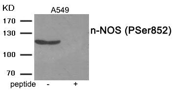 Western blot analysis of extracts from A549 tissue using n-NOS (Phospho-Ser852) antibody.The lane on the right is treated with the antigen-specific peptide.