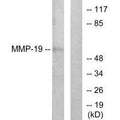 Western blot analysis of extracts from HuvEc cells, using MMP-19 antibody.