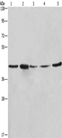 Gel: 10%SDS-PAGE, Lysate: 40 ug, Lane 1-5: A549 cells, NIH/3T3 cells, 293T cells, human hepatocellular carcinoma tissue, hela cells, Primary antibody: CSB-PA197545(RPSA Antibody) at dilution 1/425, Secondary antibody: Goat anti rabbit IgG at 1/8000 dilution, Exposure time: 30 seconds