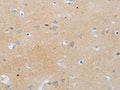 The image on the left is immunohistochemistry of paraffin-embedded Human brain tissue using CSB-PA198245(MMP25 Antibody) at dilution 1/80, on the right is treated with synthetic peptide. (Original magnification: ×200)