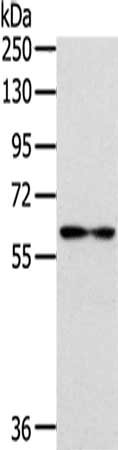 Gel: 8%SDS-PAGE,Lysate: 40 µg,Lane: Human thyroid cancer tissue,Primary antibody: CSB-PA198730(IL18R1 Antibody) at dilution 1/222 dilution,Secondary antibody: Goat anti rabbit IgG at 1/8000 dilution,Exposure time: 2 minutes