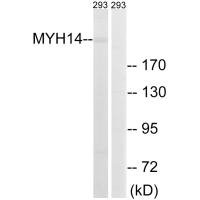 Western blot analysis of extracts from 293 cells, using MYH14 antibody.