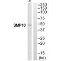 Western blot analysis of extracts from Jurkat cells, using BMP10 antibody.