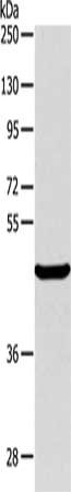 Gel: 10%SDS-PAGE, Lysate: 40 ug, Lane: Mouse pancreas tissue, Primary antibody: CSB-PA199021(ALKBH1 Antibody) at dilution 1/400, Secondary antibody: Goat anti rabbit IgG at 1/8000 dilution, Exposure time: 1 minute