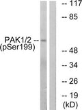 Western blot analysis of extracts from LOVO cells treated with starved using PAK1/2 (Phospho-Ser199) Antibody.The lane on the right is treated with the antigen-specific peptide.