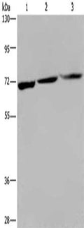 Gel: 6%SDS-PAGE, Lysate: 40 ug, Lane 1-3: 293T cells, PC3 cells, Jurkat cells, Primary antibody: CSB-PA199738(KLHL1 Antibody) at dilution 1/200, Secondary antibody: Goat anti rabbit IgG at 1/8000 dilution, Exposure time: 2 minutes
