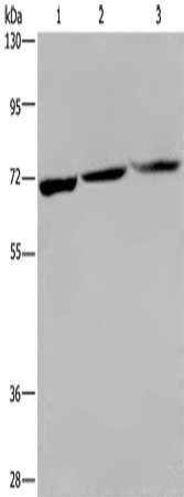 Gel: 6%SDS-PAGE, Lysate: 40 ug, Lane 1-3: 293T cells, PC3 cells, Jurkat cells, Primary antibody: CSB-PA199738(KLHL1 Antibody) at dilution 1/200, Secondary antibody: Goat anti rabbit IgG at 1/8000 dilution, Exposure time: 2 minutes